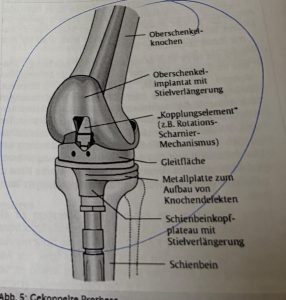 mein neues Knie seit 18.12.25